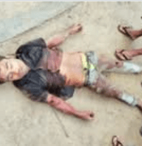 Rohingya Deadbody