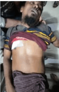 Rohingya refugee face violence