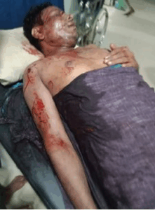 Rohingya death body pic