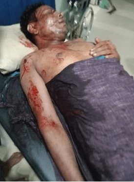 Rohingya death body pic